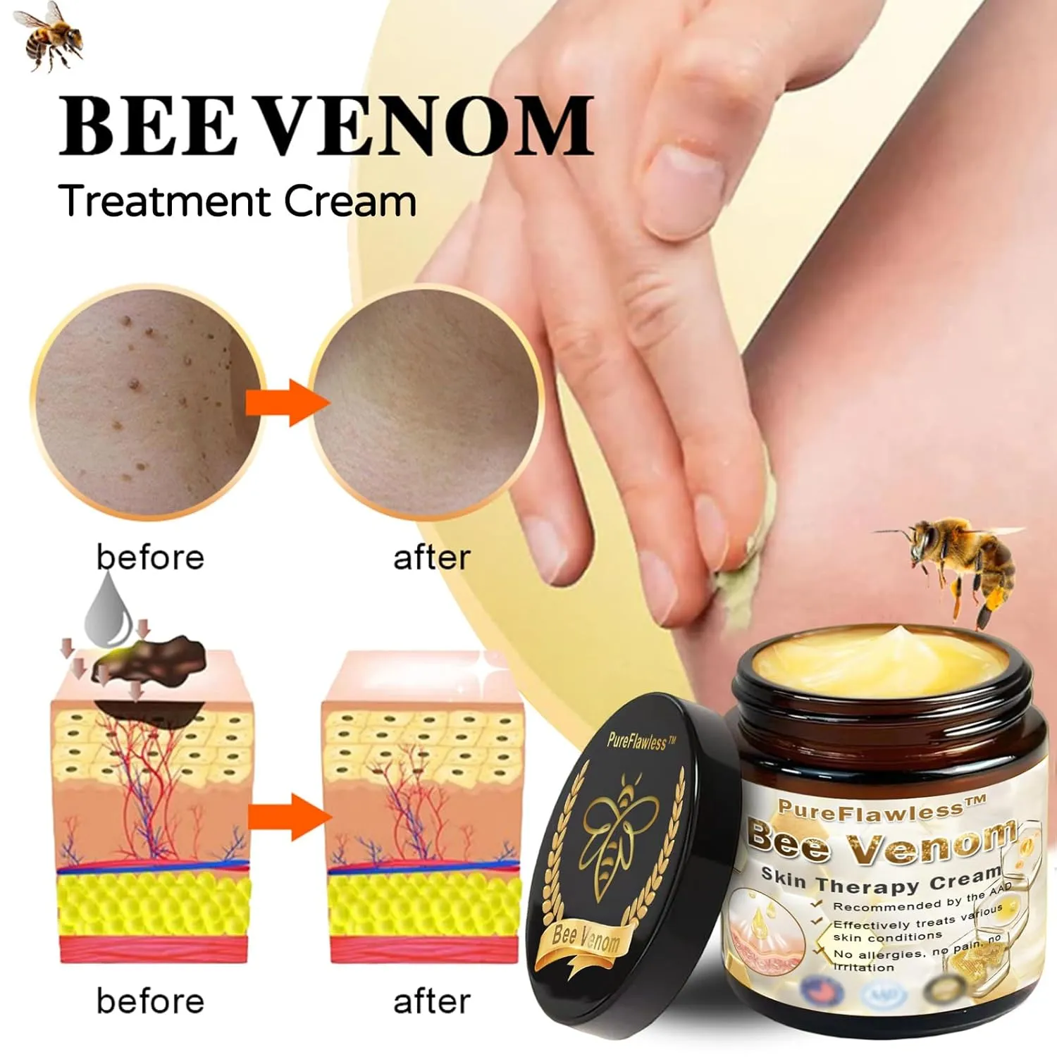 PureFlawless All-Body Powerful Skin Treatment Cream, PureFlawless Bee Venom Skin Treatment Cream, Body Blemish Repairing Skin Cream -50ML, Bee Venom Body Cream, Bee Venom Cream for All Skin Types (4)